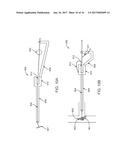 FISTULA TREATMENT DEVICES AND METHODS diagram and image