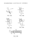 METHODS AND DEVICES TO TREAT DISEASED OR INJURED MUSCULSKELETAL TISSUE diagram and image