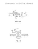 METHODS AND DEVICES TO TREAT DISEASED OR INJURED MUSCULSKELETAL TISSUE diagram and image