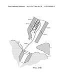 METHODS AND DEVICES TO TREAT DISEASED OR INJURED MUSCULSKELETAL TISSUE diagram and image