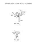 METHODS AND DEVICES TO TREAT DISEASED OR INJURED MUSCULSKELETAL TISSUE diagram and image