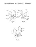 NEEDLE REMOVAL DEVICES, SYSTEMS, AND METHODS diagram and image