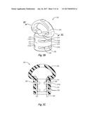 NEEDLE REMOVAL DEVICES, SYSTEMS, AND METHODS diagram and image