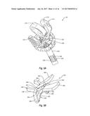 NEEDLE REMOVAL DEVICES, SYSTEMS, AND METHODS diagram and image