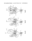 NEEDLE REMOVAL DEVICES, SYSTEMS, AND METHODS diagram and image