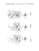 NEEDLE REMOVAL DEVICES, SYSTEMS, AND METHODS diagram and image