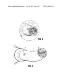 SURGICAL INSTRUMENT WITH ELONGATED CHANNEL diagram and image