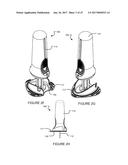 APPARATUS AND METHODS FOR INTRODUCING PORTALS IN BONE diagram and image