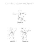 APPARATUS AND METHODS FOR INTRODUCING PORTALS IN BONE diagram and image