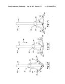 GLENOID REAMER diagram and image