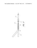 EXPANDABLE TIP ASSEMBLY FOR THROMBUS MANAGEMENT diagram and image