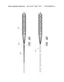 EXPANDABLE TIP ASSEMBLY FOR THROMBUS MANAGEMENT diagram and image