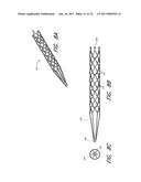 EXPANDABLE TIP ASSEMBLY FOR THROMBUS MANAGEMENT diagram and image