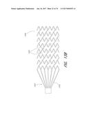 EXPANDABLE TIP ASSEMBLY FOR THROMBUS MANAGEMENT diagram and image