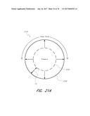 EXPANDABLE TIP ASSEMBLY FOR THROMBUS MANAGEMENT diagram and image