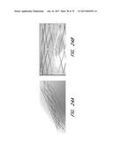 EXPANDABLE TIP ASSEMBLY FOR THROMBUS MANAGEMENT diagram and image