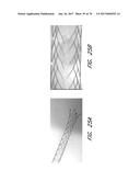 EXPANDABLE TIP ASSEMBLY FOR THROMBUS MANAGEMENT diagram and image