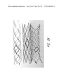 EXPANDABLE TIP ASSEMBLY FOR THROMBUS MANAGEMENT diagram and image