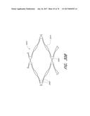 EXPANDABLE TIP ASSEMBLY FOR THROMBUS MANAGEMENT diagram and image