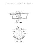 EXPANDABLE TIP ASSEMBLY FOR THROMBUS MANAGEMENT diagram and image