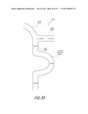 EXPANDABLE TIP ASSEMBLY FOR THROMBUS MANAGEMENT diagram and image