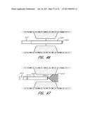 EXPANDABLE TIP ASSEMBLY FOR THROMBUS MANAGEMENT diagram and image