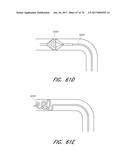 EXPANDABLE TIP ASSEMBLY FOR THROMBUS MANAGEMENT diagram and image