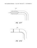 EXPANDABLE TIP ASSEMBLY FOR THROMBUS MANAGEMENT diagram and image