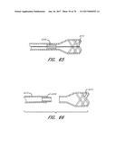 EXPANDABLE TIP ASSEMBLY FOR THROMBUS MANAGEMENT diagram and image