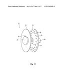 INTERSPINOUS PROCESS DEVICE AND METHOD diagram and image