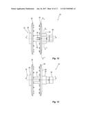 INTERSPINOUS PROCESS DEVICE AND METHOD diagram and image