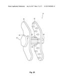 INTERSPINOUS PROCESS DEVICE AND METHOD diagram and image