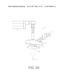 SURGICAL VISUALIZATION SYSTEMS AND DISPLAYS diagram and image