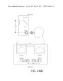 SURGICAL VISUALIZATION SYSTEMS AND DISPLAYS diagram and image