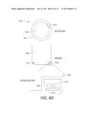 SURGICAL VISUALIZATION SYSTEMS AND DISPLAYS diagram and image