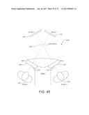 SURGICAL VISUALIZATION SYSTEMS AND DISPLAYS diagram and image