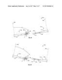 INTRAOCULAR LENS DEVICES, SYSTEMS, AND RELATED METHODS diagram and image