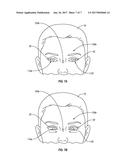 INTRAOCULAR LENS DEVICES, SYSTEMS, AND RELATED METHODS diagram and image