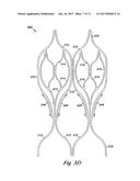 VENOUS VALVE, SYSTEM, AND METHOD WITH SINUS POCKET diagram and image