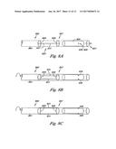 VENOUS VALVE, SYSTEM, AND METHOD WITH SINUS POCKET diagram and image