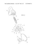 METHODS FOR AUGMENTING FEMORAL COMPONENTS OF KNEE JOINT PROSTHESES diagram and image