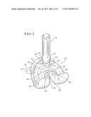 METHODS FOR AUGMENTING FEMORAL COMPONENTS OF KNEE JOINT PROSTHESES diagram and image