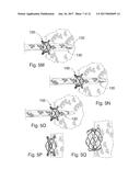 PERCUTANEOUS HEART VALVE diagram and image