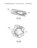 PERCUTANEOUS HEART VALVE diagram and image