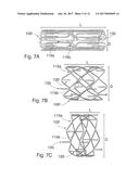 PERCUTANEOUS HEART VALVE diagram and image