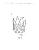 ARTICULATED COMMISSURE VALVE STENTS AND METHODS diagram and image