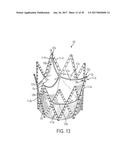 ARTICULATED COMMISSURE VALVE STENTS AND METHODS diagram and image