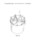 ARTICULATED COMMISSURE VALVE STENTS AND METHODS diagram and image