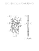 ARTICULATED COMMISSURE VALVE STENTS AND METHODS diagram and image