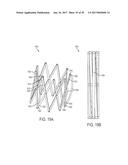 ARTICULATED COMMISSURE VALVE STENTS AND METHODS diagram and image